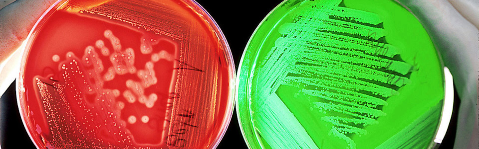 Badania bakteriologiczne i mykologiczne