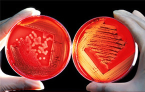 Badania bakteriologiczne